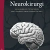 Neurokirurgi